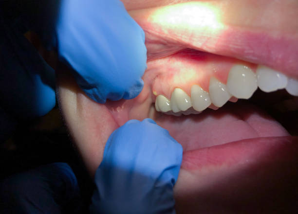Best Emergency Cosmetic Dentistry (e.g., broken veneers) in Wrens, GA